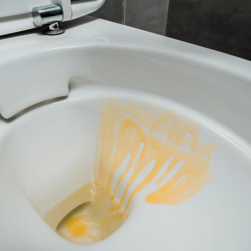 close up view of yellow stain in toilet